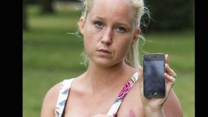 Şarjdaki iPhone genç kadının göğsünü yaktı