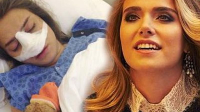 Ceyda Ateş'in burnu kırıldı