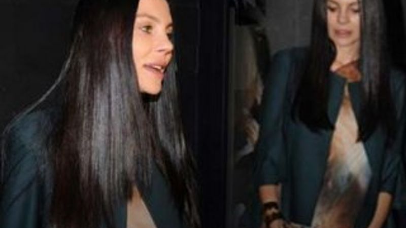 Günay Musayeva estetik yaptırdı