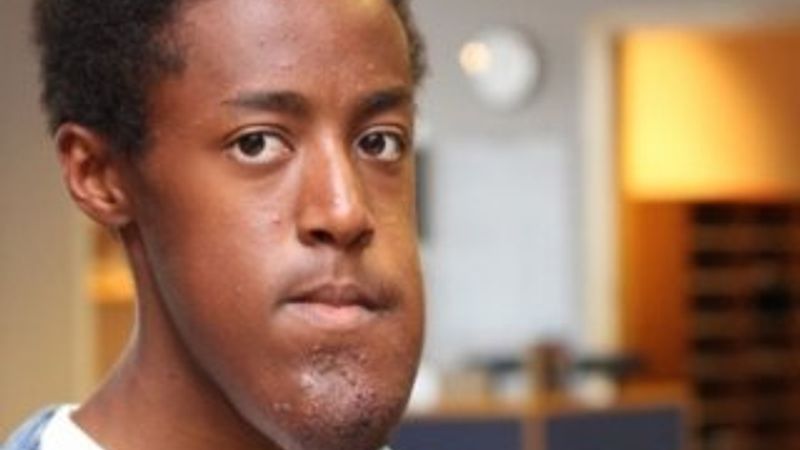 Facebook yüzünde rahatsızlık olan gencin profilini sildi