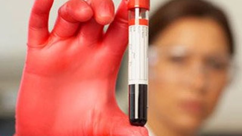 Kan testi yaptırırken dikkat edilmesi gerekenler