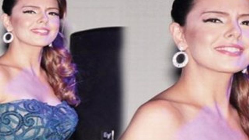 Ebru Gündeş estetik mi yaptırdı