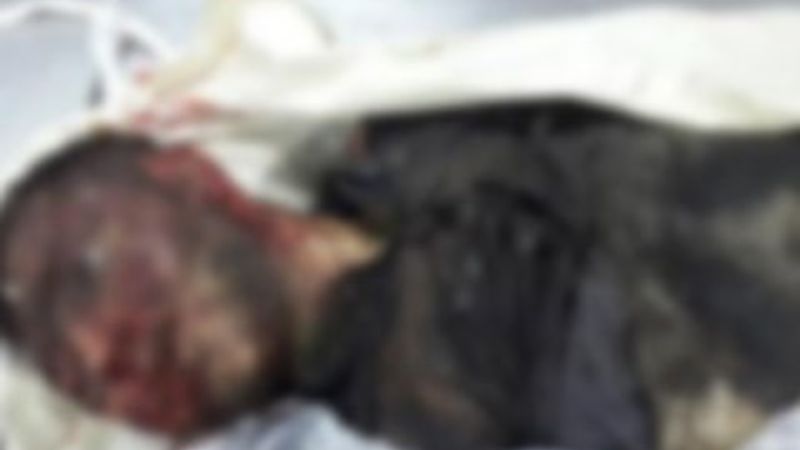 Başı taşla ezilen genç Berkin Elvan gibi sahiplenilmedi