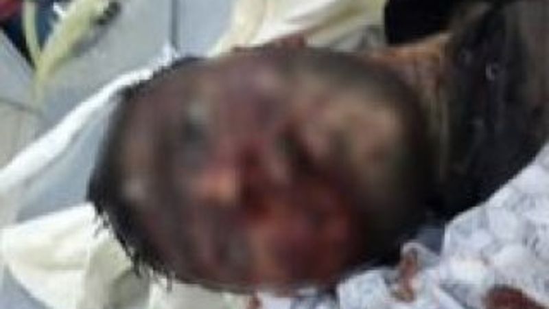 Diyarbakır'daki eylemlerde cesetlere de işkence yapılmış