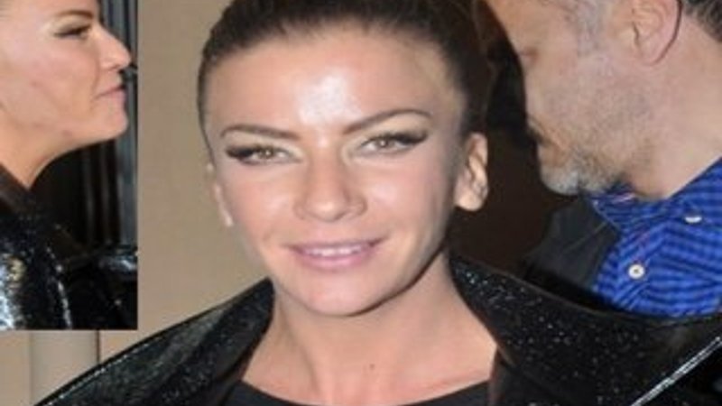 Ivana Sert'in yüzündeki sivilceler şaşırttı