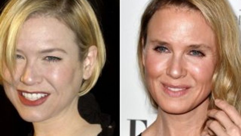 Renee Zellweger Michael Jackson sendromuna yakalandı