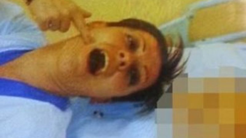 Cesetlerle selfie çeken hemşire görevden alındı