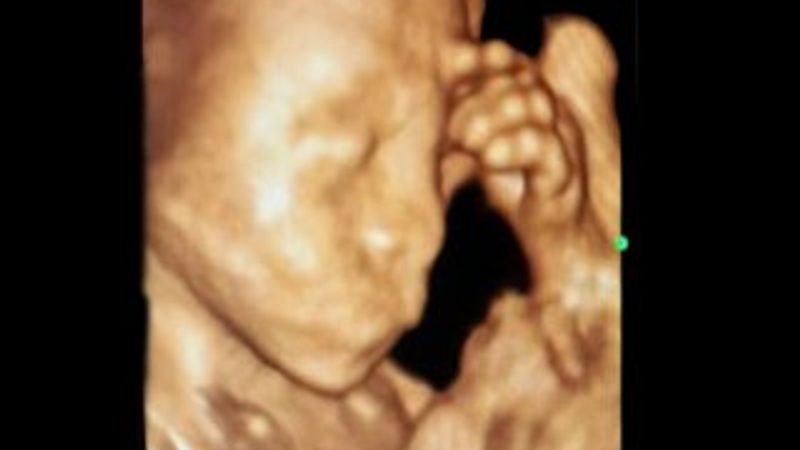 Anne karnında düşünen bebek