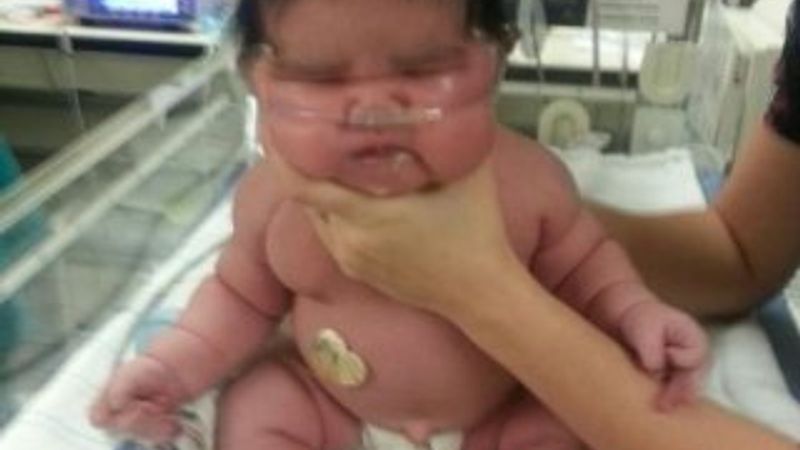 ABD'de 6 kiloluk bir bebek doğdu