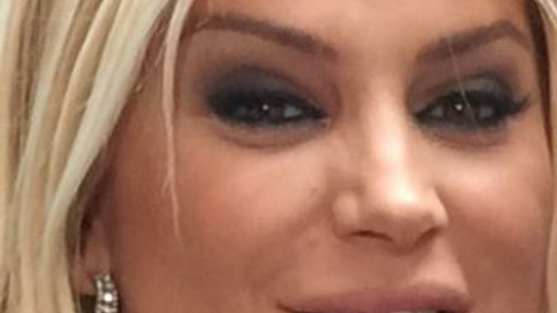 Songül Karlı estetik yaptırdı