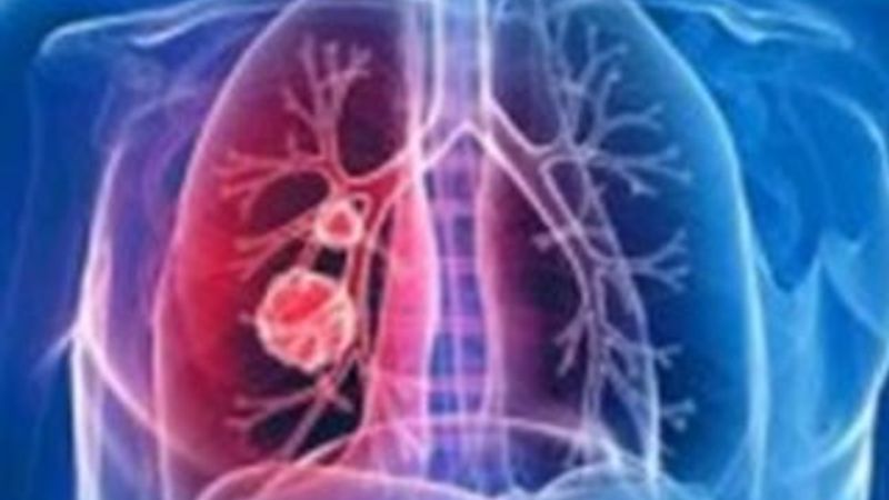 Elektronik burun yöntemi Türkiye'ye gelecek