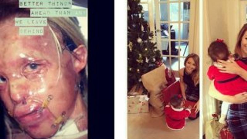 Katie Piper'in yeni yüzü