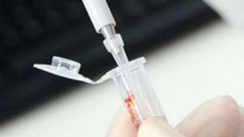 Kanada'da kuş gribi vakası