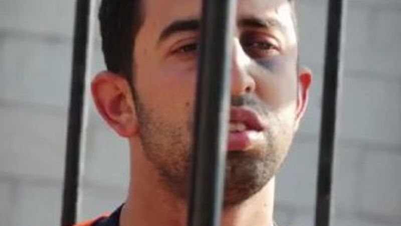 Diri diri yakılan pilotun sakinliğinin sebebi belli oldu