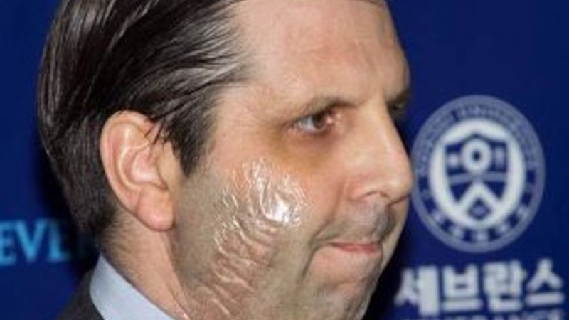 Amerikalı elçi Mark Lippert taburcu edildi