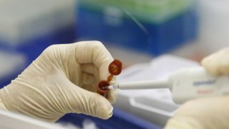 Çanakkale'de 4 hastada domuz gribi saptandı