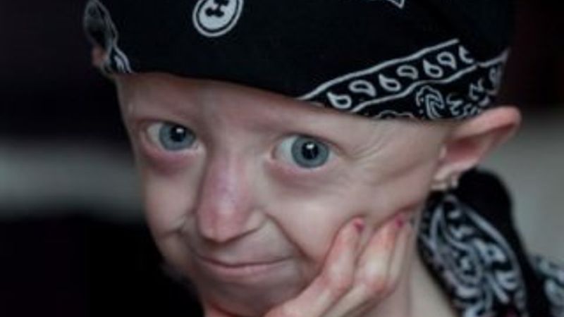 104 yaşındaki genç kız 17 yaşında hayatını kaybetti