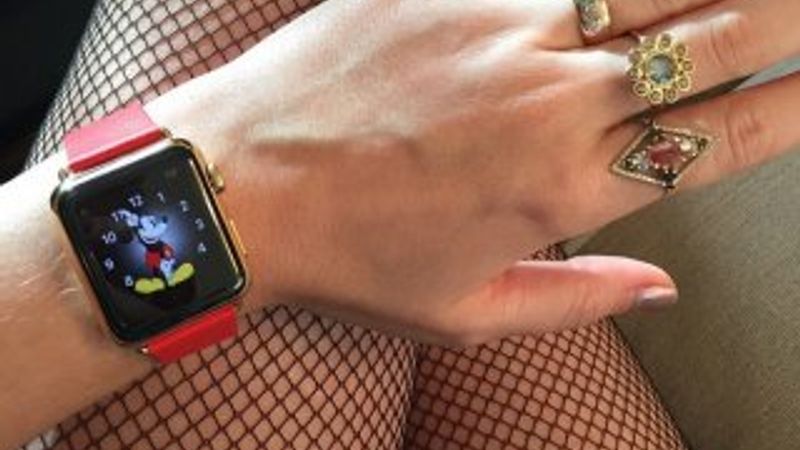 Apple Watch anket sonuçları