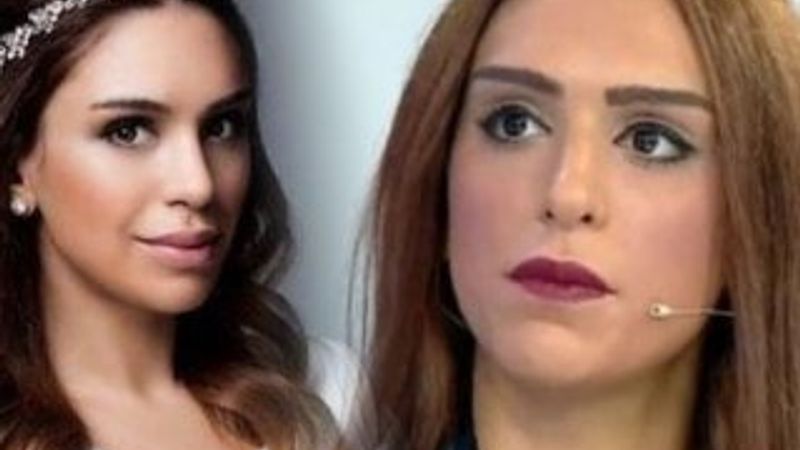 Tuğçe Ergişi estetik yaptırdı