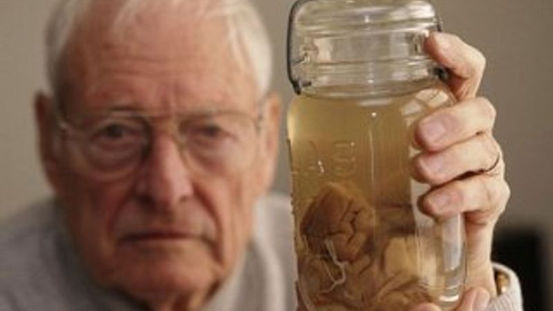 Müzede ziyarete açılan Einstein'ın beynine ilgi yoğun