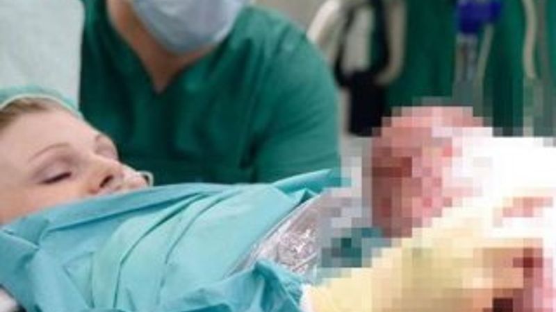 Alman kadın doğumunda bebeğini karnından kendisi çıkardı