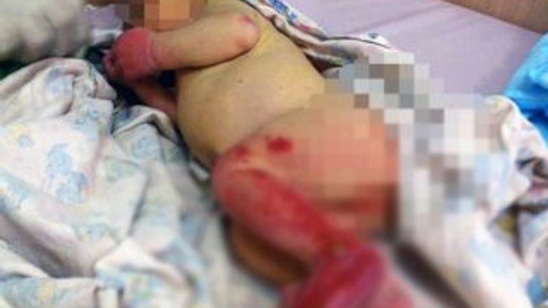 Rusya'da ormana terk edilen bebeği karıncalar yedi