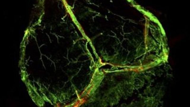 Beyinde lenf damarı bulundu