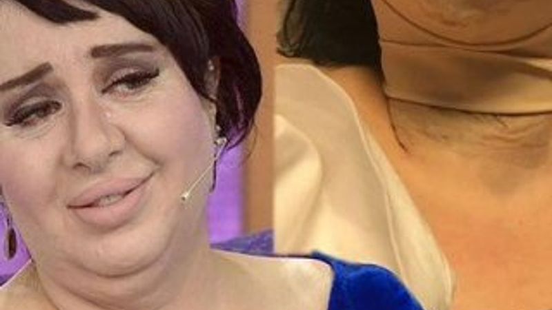 Nur Yerlitaş gıdısını aldırdı