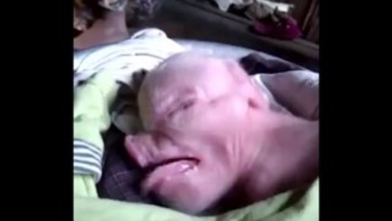 ABD'de domuz suratlı bebek doğdu