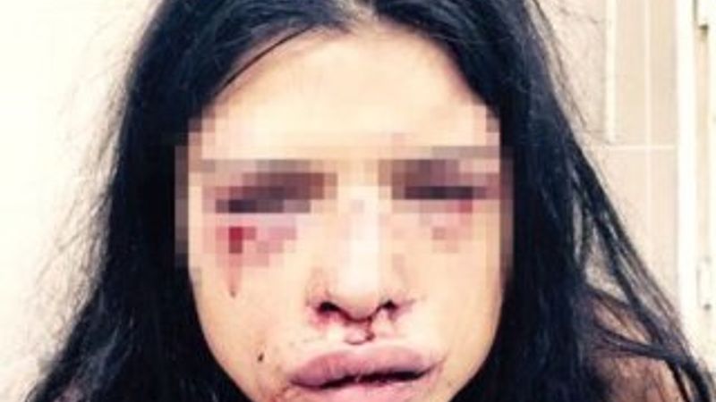 Özbizerdik'in dövdüğü kız arkadaşı şikayetini geri aldı