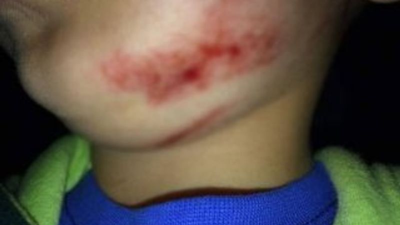 Belçika'da öğretmen öğrencisini darp etti