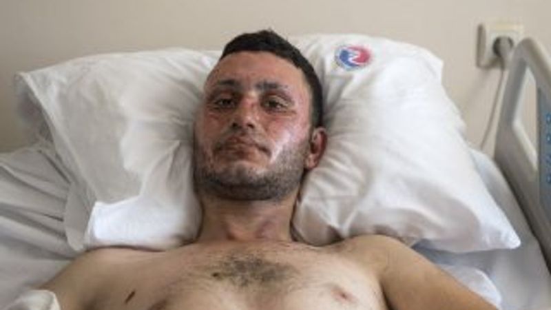 Patlamada yaralanan genç o anları anlattı
