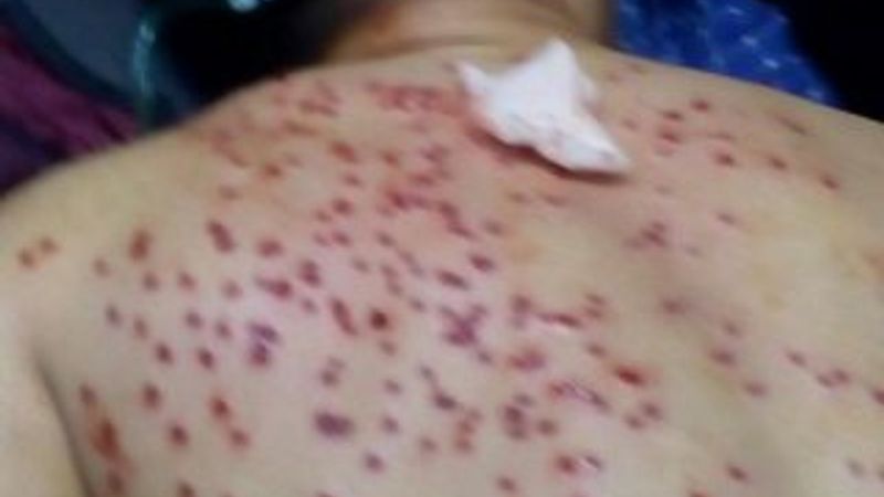 Güvercin kavgasını ayırmak isterken 200 sacmayla vuruldu