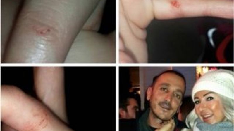 Sevgilisi Nazlı Hamarat'ı dövdü