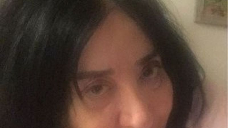 Nur Yerlitaş makyajsız