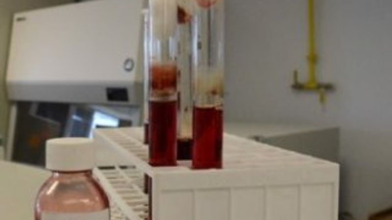 ’Yapay kan’ denemeleri başlıyor