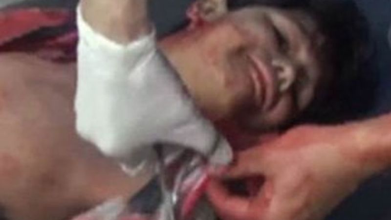 Bombardımanda yaralanan çocuk: Cici elbiselerimi kesmeyin