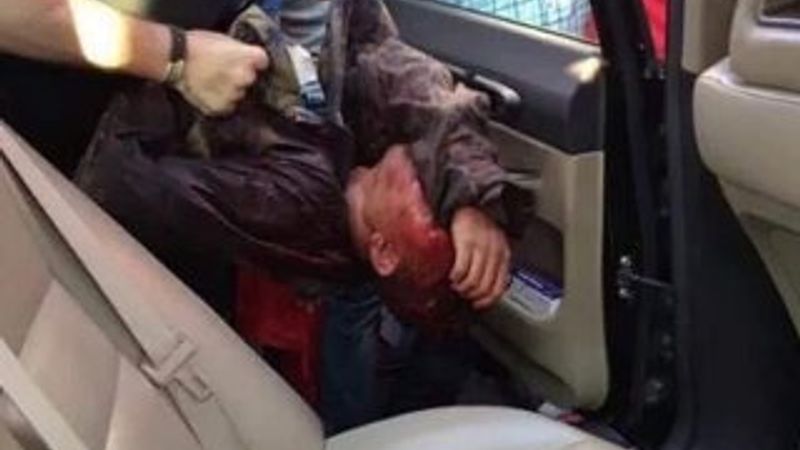 Askerin kafası kesildi iddialarını yalanlayan fotoğraf