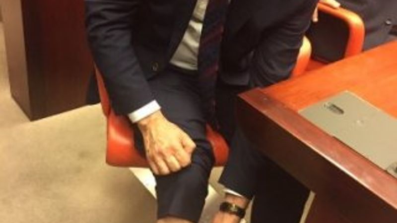 Eren Erdem AK Partili vekili bacağından ısırdı