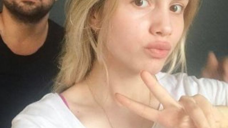 Aleyna Tilki estetik yaptırdı