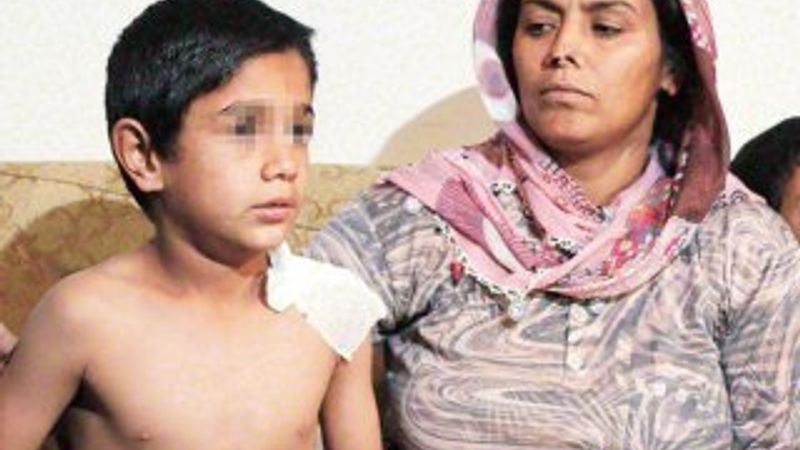 Üzerine sıcak su dökülen Suriyeli çocuk konuştu