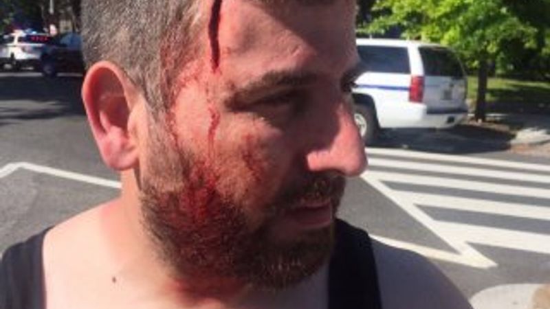 Washington Türk Büyükelçilik konutu önünde aslında neler yaşandı