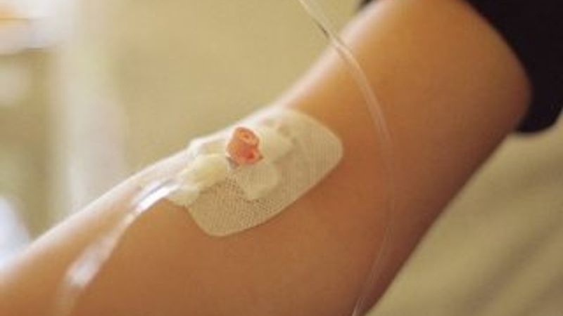 Serum nasıl yapılır