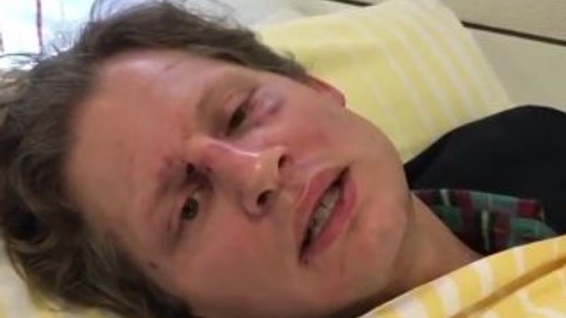 Terör örgütü PKK yandaşları Alman gazeteciye saldırdı