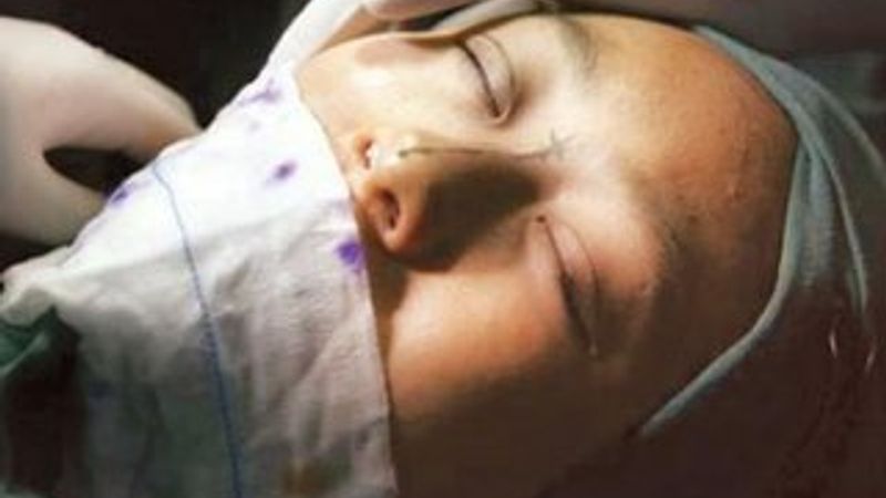 Çinli kadın borcunu ödememek için estetik yaptırdı