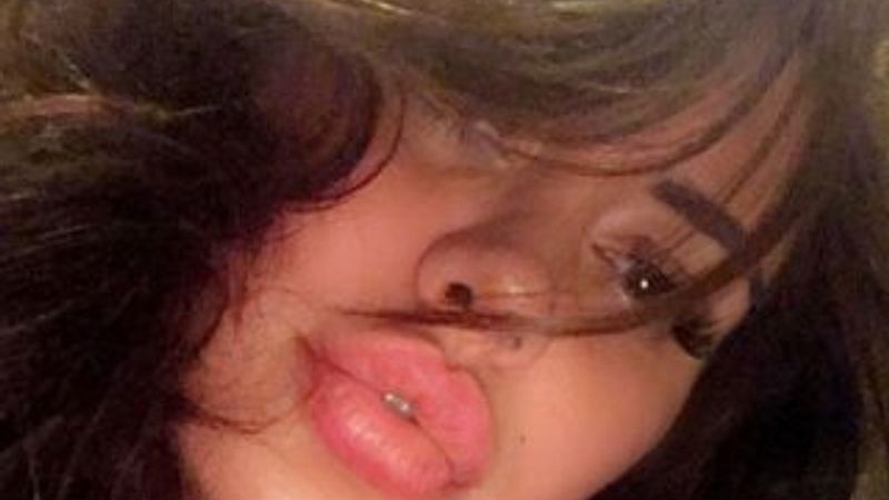 Ebru Polat'ın yeni dudakları