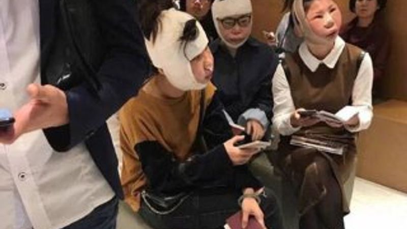 Estetik sevdası Çinli 3 kadına pahalıya patladı