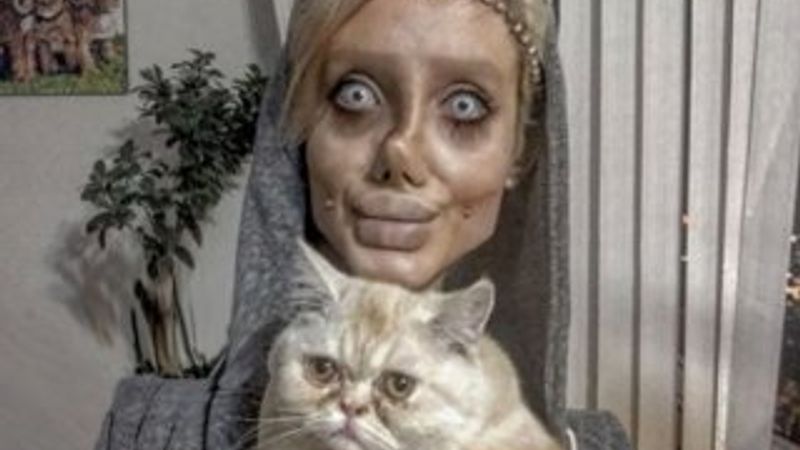 İranlı kadın, Jolie'ye benzemek isterken çirkinleşti