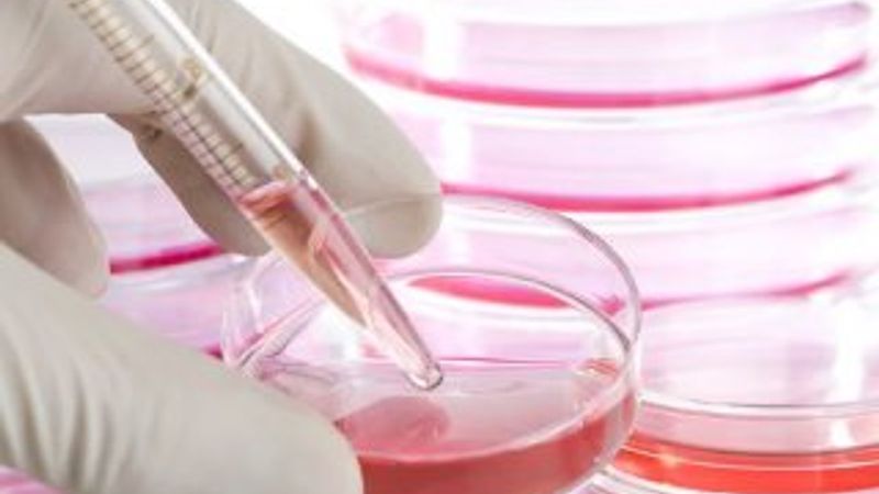 PRP mi kök hücre mi