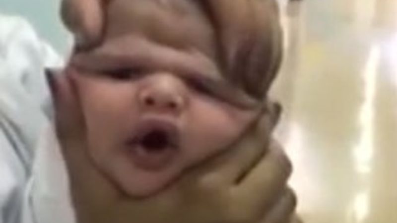 Hemşireler bebeğin suratıyla dalga geçti